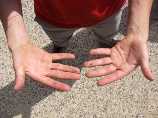aauwchh... de MC-ladies kunnen tegen een stootje...Marijkes handen na 3 dagen klimmen