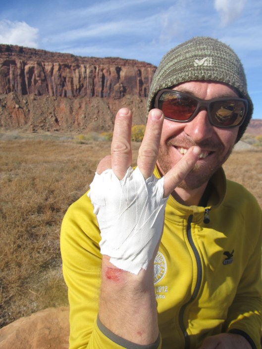 Tricky Ricky and his tape gloves